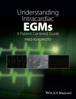 Understanding Intracardiac EGMs: A Patient Centered Guide - ISBN 9781118721360