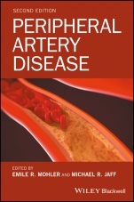Peripheral Artery Disease - ISBN 9781118776094
