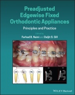 Preadjusted Edgewise Fixed Orthodontic Appliances: Principles and Practice - ISBN 9781118817698