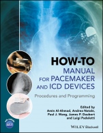 How–to Manual for Pacemaker and ICD Devices: Procedures and Programming - ISBN 9781118820599