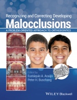 Recognizing and Correcting Developing Malocclusions: A Problem–Oriented Approach to Orthodontics - ISBN 9781118886120