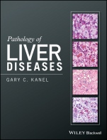 Pathology of Liver Diseases - ISBN 9781118895030