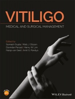 Vitiligo: Medical and Surgical Management - ISBN 9781118937419