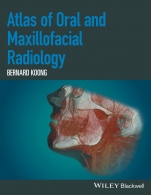 Atlas of Oral and Maxillofacial Radiology - ISBN 9781118939642