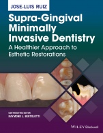 Supra–Gingival Minimally Invasive Dentistry: A Healthier Approach to Esthetic Restorations - ISBN 9781118976418