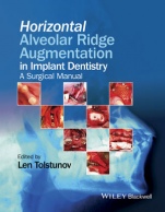 Horizontal Alveolar Ridge Augmentation in Implant Dentistry: A Surgical Manual - ISBN 9781119019886