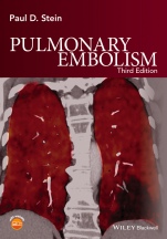Pulmonary Embolism - ISBN 9781119039082