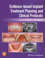 Evidence–based Implant Treatment Planning and Clinical Protocols - ISBN 9781119080039