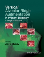 Vertical Alveolar Ridge Augmentation in Implant Dentistry: A Surgical Manual - ISBN 9781119082590