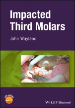 Impacted Third Molars - ISBN 9781119118336