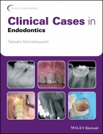 Clinical Cases in Endodontics - ISBN 9781119147046