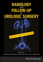 Radiology and Follow–up of Urologic Surgery - ISBN 9781119162087