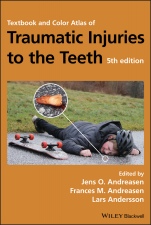 Textbook and Color Atlas of Traumatic Injuries to the Teeth - ISBN 9781119167051