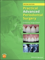 Practical Advanced Periodontal Surgery - ISBN 9781119196310