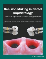 Decision Making in Dental Implantology: Atlas of Surgical and Restorative Approaches - ISBN 9781119225942