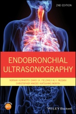 Endobronchial Ultrasonography - ISBN 9781119233947