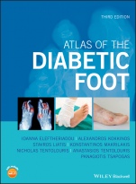 Atlas of the Diabetic Foot - ISBN 9781119255239