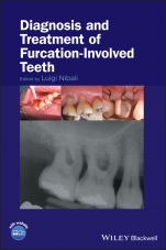 Diagnosis and Treatment of Furcation–Involved Teeth - ISBN 9781119270652
