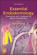 Essential Endodontology: Prevention and Treatment of Apical Periodontitis - ISBN 9781119271956