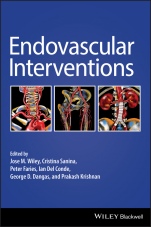 Endovascular Interventions - ISBN 9781119283492