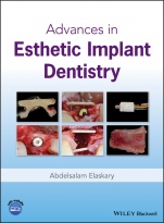 Advances in Esthetic Implant Dentistry - ISBN 9781119286677