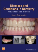 Diseases and Conditions in Dentistry: An Evidence–Based Reference - ISBN 9781119312031