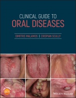Clinical Guide to Oral Diseases - ISBN 9781119328117