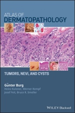 Atlas of Dermatopathology: Tumors, Nevi, and Cysts - ISBN 9781119371540