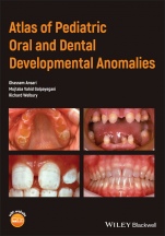 Atlas of Pediatric Oral and Dental Developmental Anomalies - ISBN 9781119380856