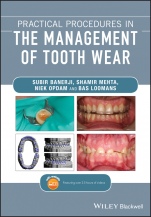 Practical Procedures in the Management of Tooth Wear - ISBN 9781119389866