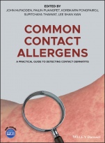 Common Contact Allergens: A Practical Guide to Detecting Contact Dermatitis - ISBN 9781119405665