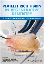 Platelet Rich Fibrin in Regenerative Dentistry: Biological Background and Clinical Indications - ISBN 9781119406815