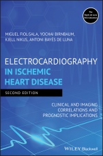 Electrocardiography in Ischemic Heart Disease: Clinical and Imaging Correlations and Prognostic Implications - ISBN 9781119422662