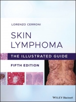 Skin Lymphoma: The Illustrated Guide - ISBN 9781119485902