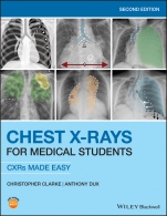 Chest X–Rays for Medical Students: CXRs Made Easy - ISBN 9781119504153