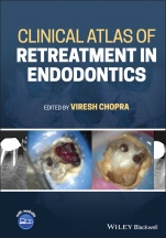 Clinical Atlas of Retreatment in Endodontics - ISBN 9781119509202