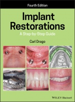 Implant Restorations: A Step–by–Step Guide - ISBN 9781119538110