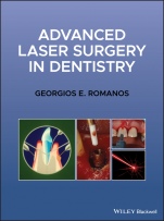 Advanced Laser Surgery in Dentistry - ISBN 9781119583301