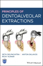 Principles of Dentoalveolar Extractions - ISBN 9781119596400