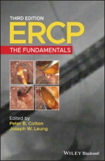Ercp: The Fundamentals - ISBN 9781119601098