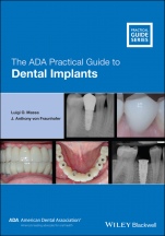 The ADA Practical Guide to Dental Implants - ISBN 9781119630692