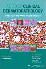 Atlas of Clinical Dermatopathology: Infectious and Parasitic Dermatoses - ISBN 9781119647065