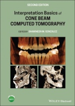 Interpretation Basics of Cone Beam Computed Tomography - ISBN 9781119685845