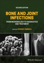 Bone and Joint Infections: From Microbiology to Diagnostics and Treatment - ISBN 9781119720652