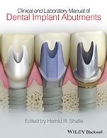 Clinical and Laboratory Manual of Dental Implant Abutments - ISBN 9781119949817