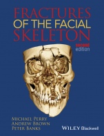 Fractures of the Facial Skeleton - ISBN 9781119967668