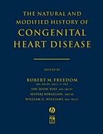 The Natural and Modified History of Congenital Heart Disease - ISBN 9781405103602