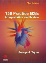 150 Practice ECGs: Interpretation and Review - ISBN 9781405104838