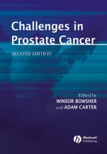Challenges in Prostate Cancer - ISBN 9781405107525