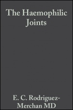 The Haemophilic Joints: New Perspectives - ISBN 9781405112307